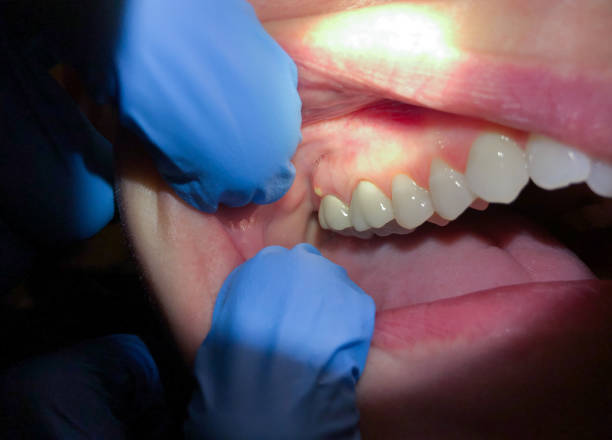 Best Walk-In Emergency Dental Services in Stiles, PA