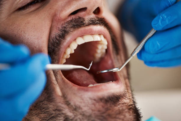Best Broken or Chipped Tooth Repair in Stiles, PA
