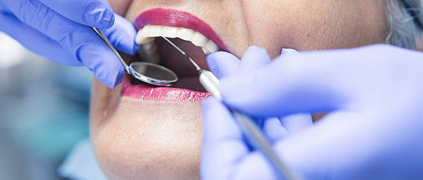 Best Broken or Chipped Tooth Repair in Stiles, PA